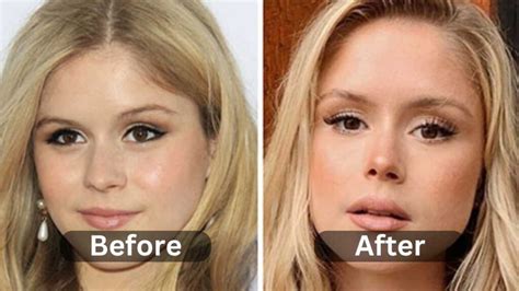 erin moriarty breast implants|Erin Moriarty Plastic Surgery Before and After